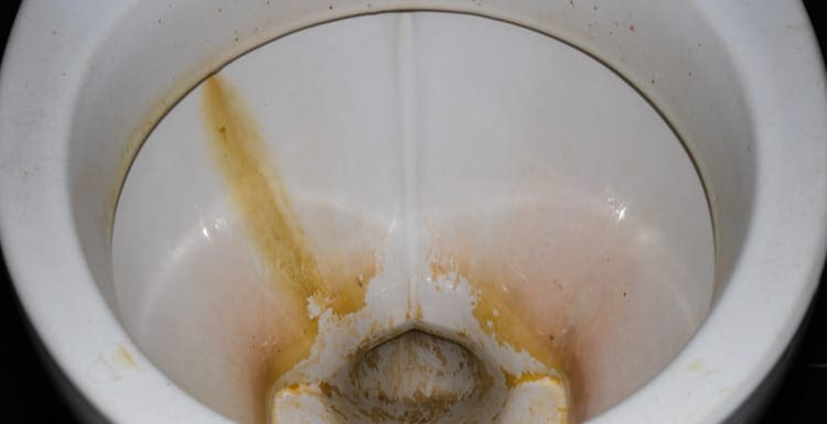 Yellow stain for long time on flush toilet as an image for a piece on how to remove hard water stains from toilet